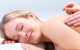 acupunctureback1 265x165 “Mainstream” Doctors and Nurses Often Use Alternative Medicine for Themselves